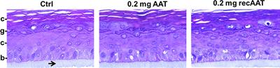 The Delivery of α1-Antitrypsin Therapy Through Transepidermal Route: Worthwhile to Explore